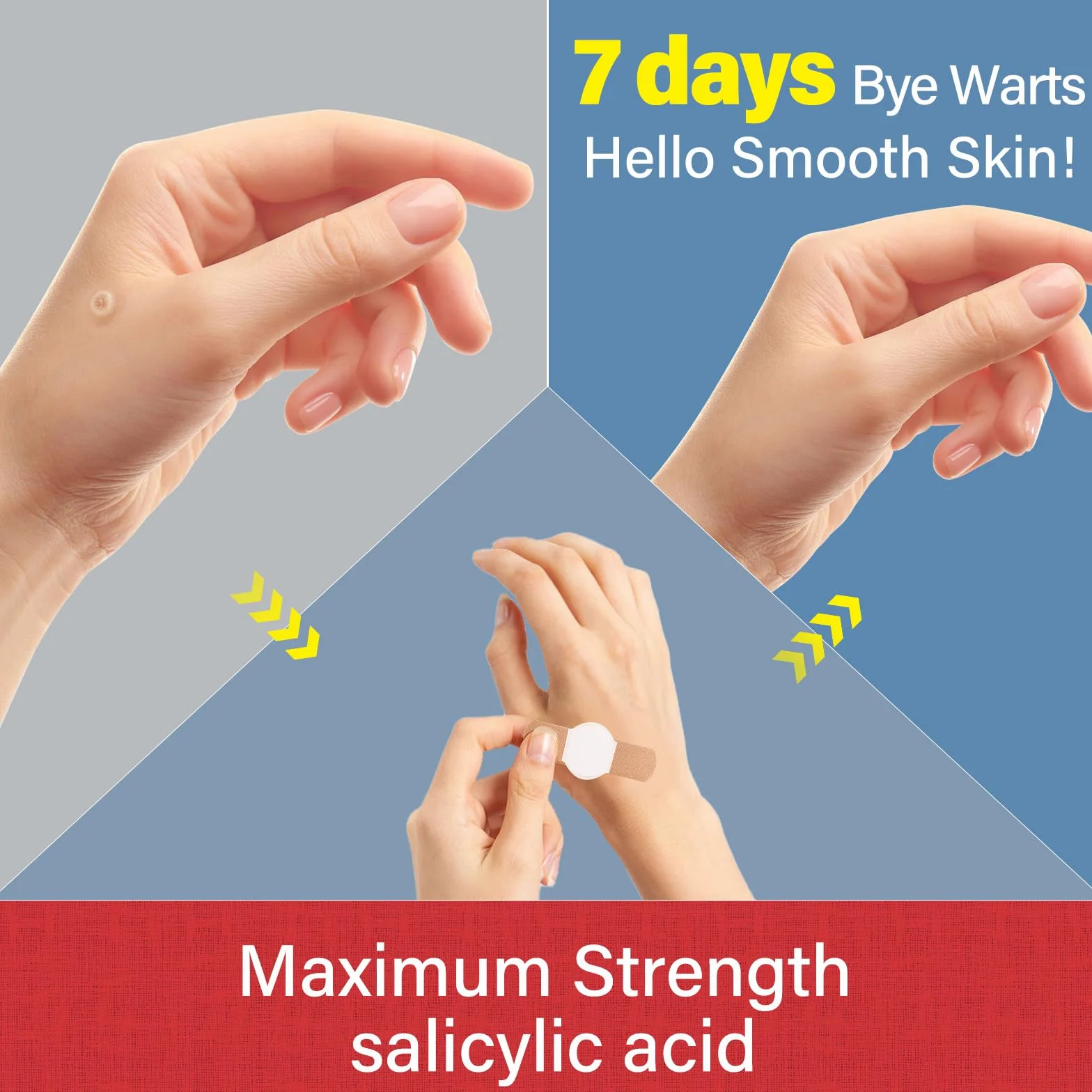 Wart Remover Pad, 10