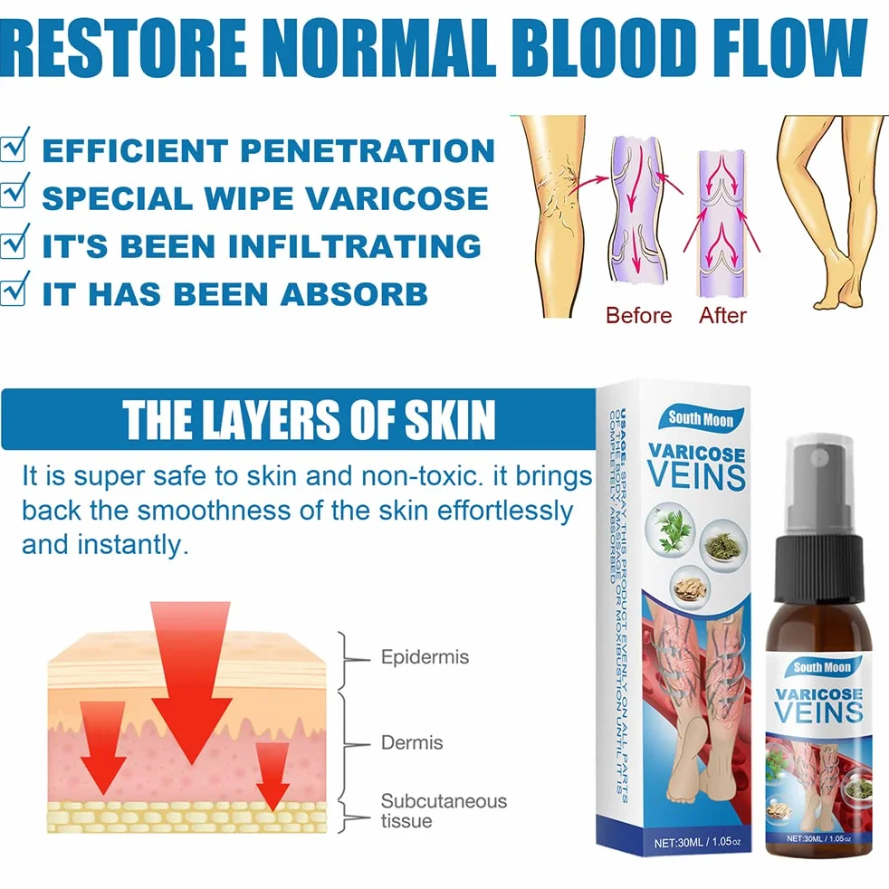 Veinhealing Veins Treatment Spray, 3 szt. Spray do żylaków Veinhealing, naturalny spray ziołowy dla żylaków, 30 ml