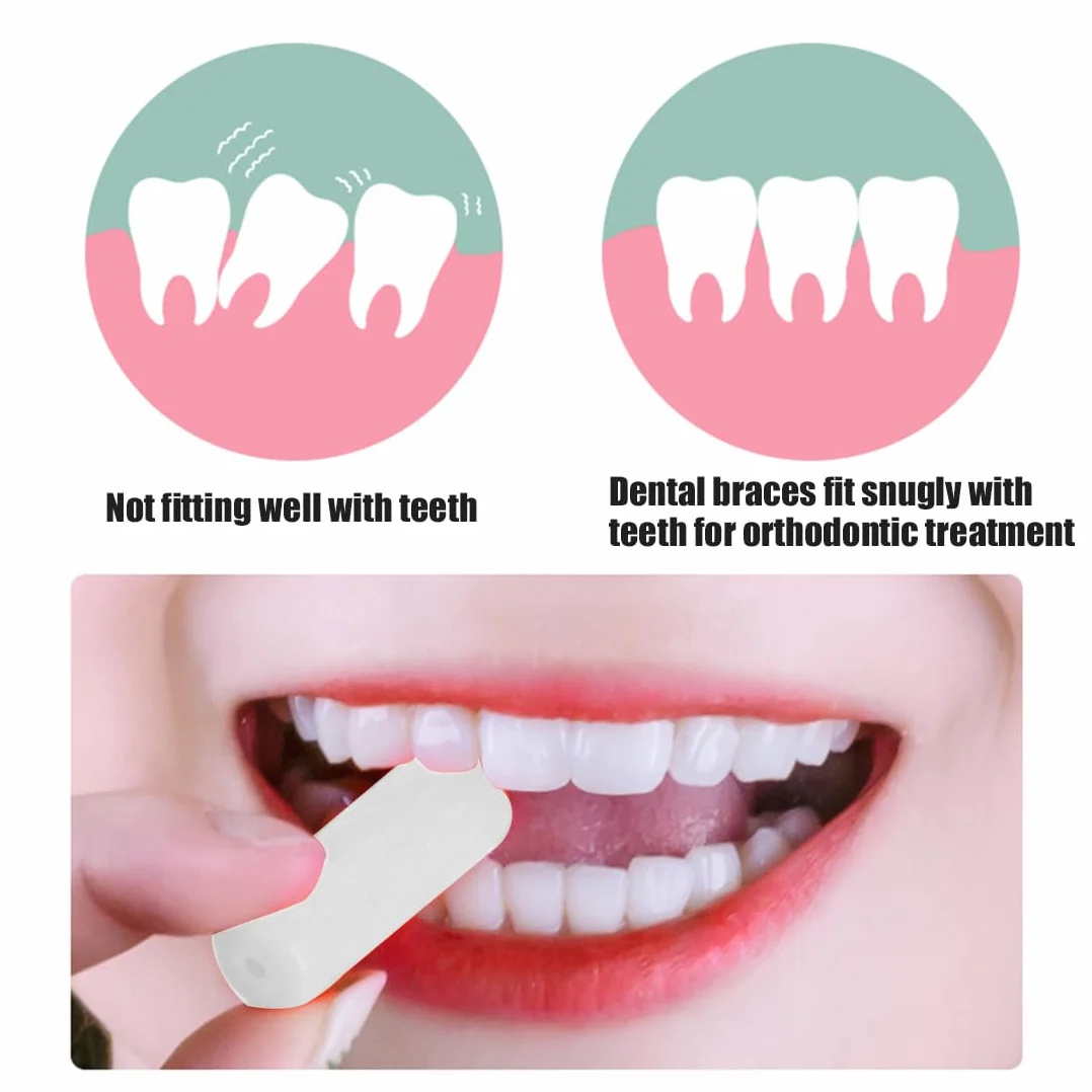 WeddHuis 2 sztuki tacy Aligner Chewies Aligner Chewies Chomper do wyrównania tacek