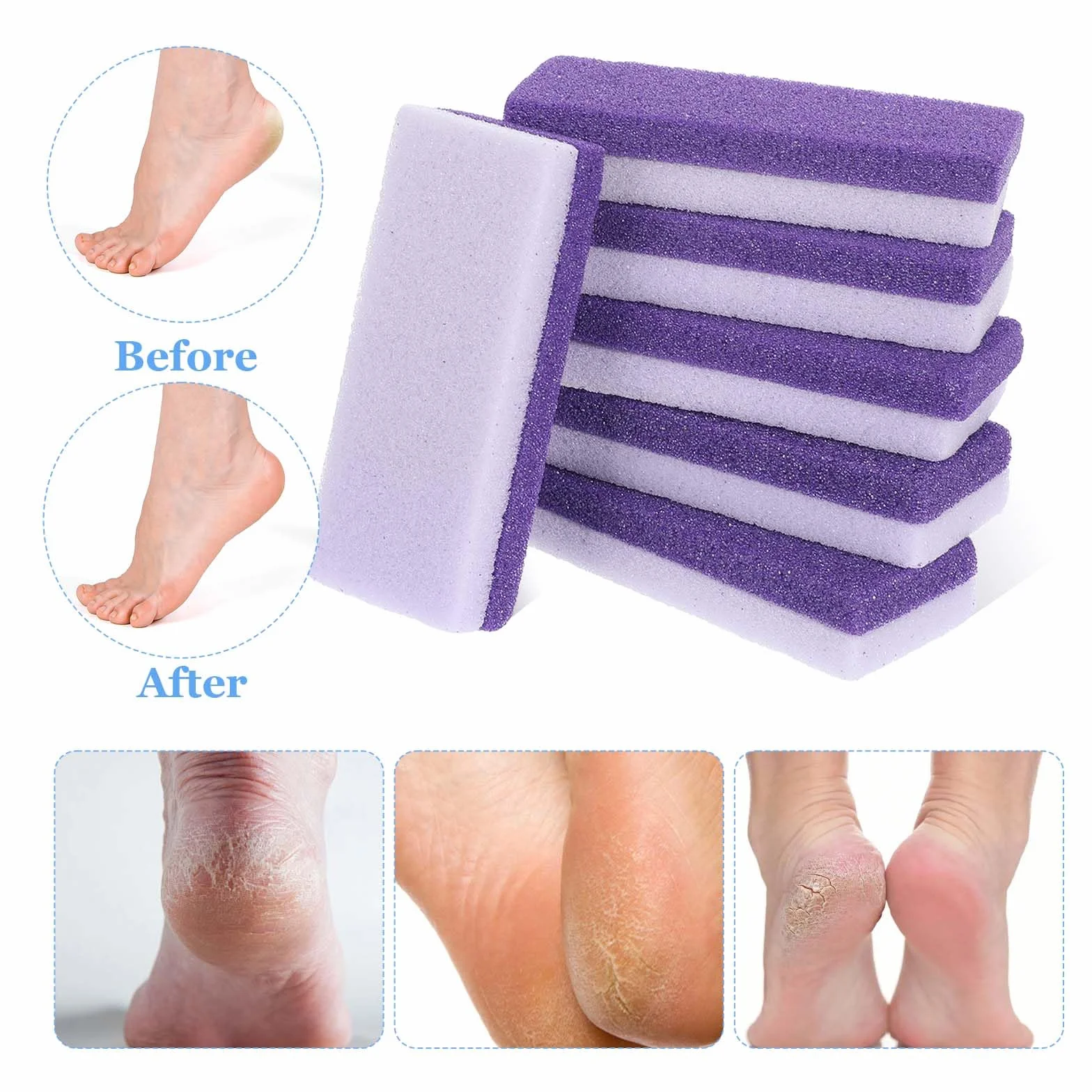 Pumeks do stóp, pedicure, pumeks, pedikiur, środek do usuwania pilników, złuszczacz do stóp, twarda skóra, martwe skóry, prysznic, gładkie stopy, pięty, popękane pięty, naprawa pończoch, 6 szt