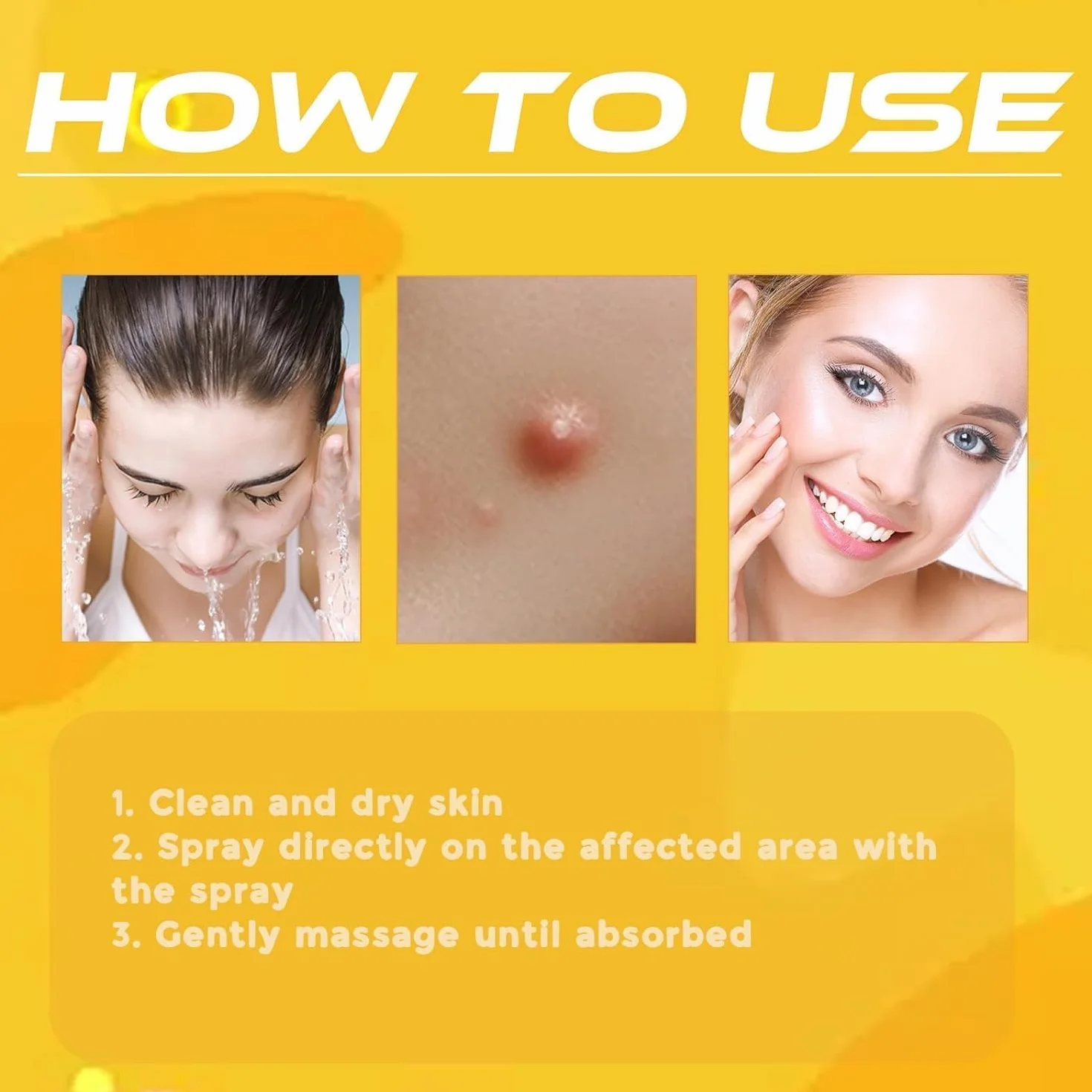 Tag Recede Bee Venom, 20 ml Tag Recede Bee Venom Spray, Tagrecede Bee Venom Skin Spray (1 szt.)