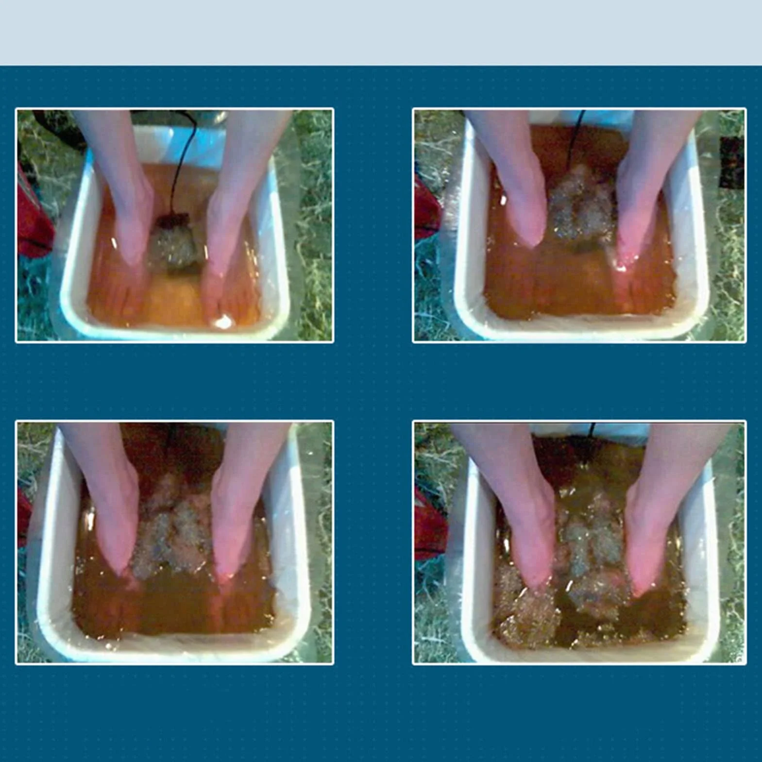 Kąpiel jonowa Detox do stóp – 10 okrągłych elektrod ze stali nierdzewnej, system spa do detoksykacji, sprzęt do domowego wellness