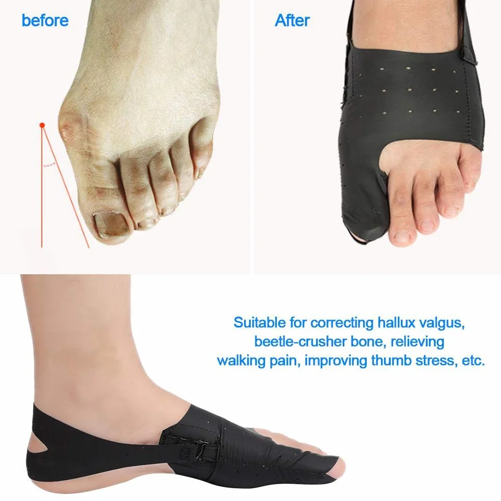 Korektor haluksów koślawego, ultracienki korektor palucha i palca, separator bunion, ortopedyczny hallux koślawy, aparat ortopediczny i palce u stóp, do łagodzenia bólu stóp, szyna na dzień lub (M)