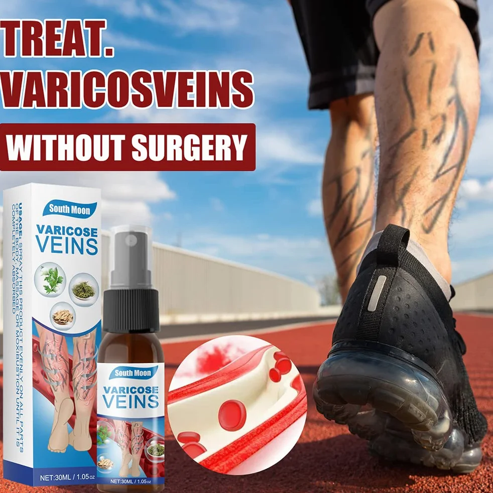 Veinhealing Veins Treatment Spray, 3 szt. Spray do żylaków Veinhealing, naturalny spray ziołowy dla żylaków, 30 ml