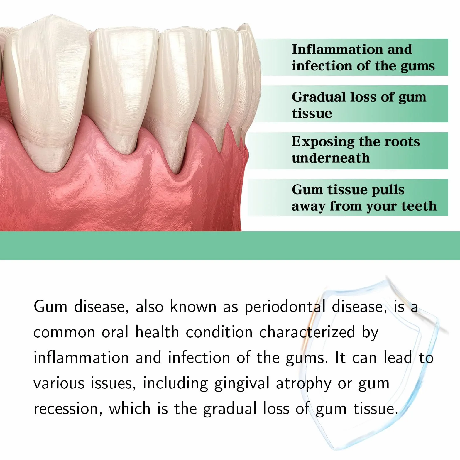 Gum Regrowth krople do regeneracji dziąseł, krople do leczenia regeneracji dziąseł, serum wybielające zęby, łatwe odnawianie dziąseł, naprawa cofających się dziąseł (1 szt.)