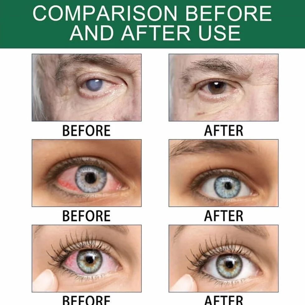 Optivipro Presbyopia Eye Drops,Vision Recovery Eye Drops,Relieve Eye Fatigue,For Eye Care (20Pcs)