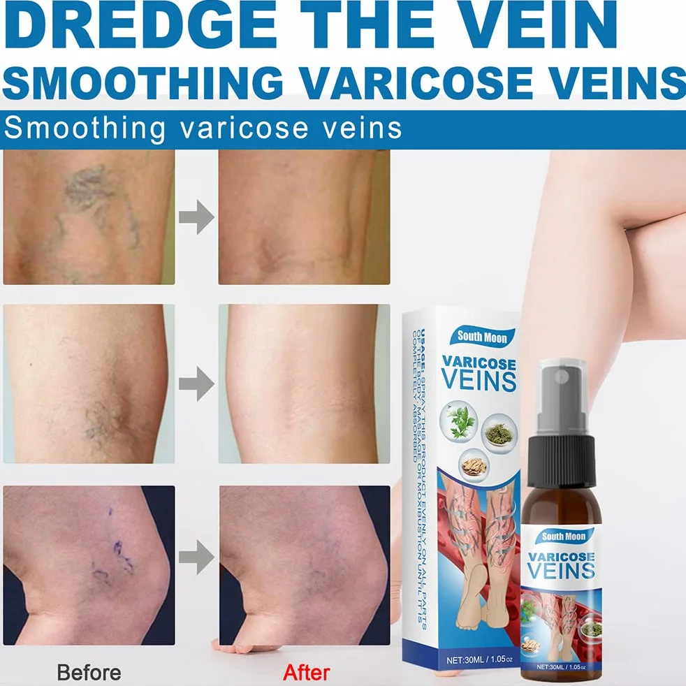 Veinhealing Veins Treatment Spray, 3 szt. Spray do żylaków Veinhealing, naturalny spray ziołowy dla żylaków, 30 ml