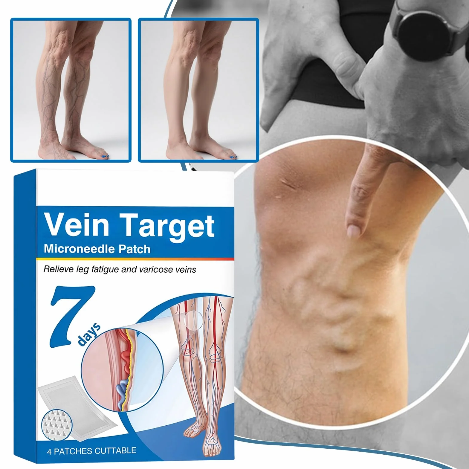 Vein Target plastry z mikroigłami | Zaawansowane plastry na żylaki | 4 sztuki Naturalne Długotrwałe Oddychające Łagodzenie Dyskomfortu Podkładki na Nogi Dla Mężczyzn Kobiet Dorosłych Seniorów