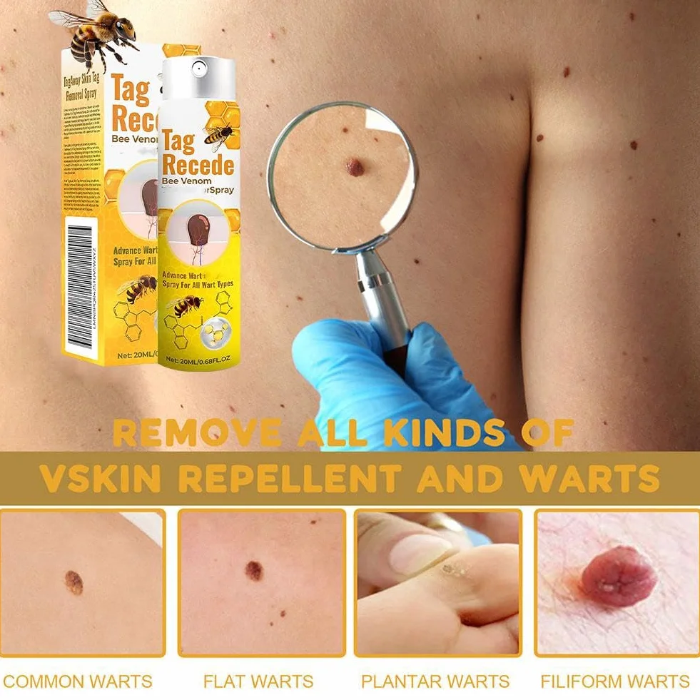 Tag Recede Bee Venom, spray do usuwania brodawek i znaczników jadu pszczół, spray do usuwania jadu pszczelego dla kobiet i mężczyzn, 20 ml/szt