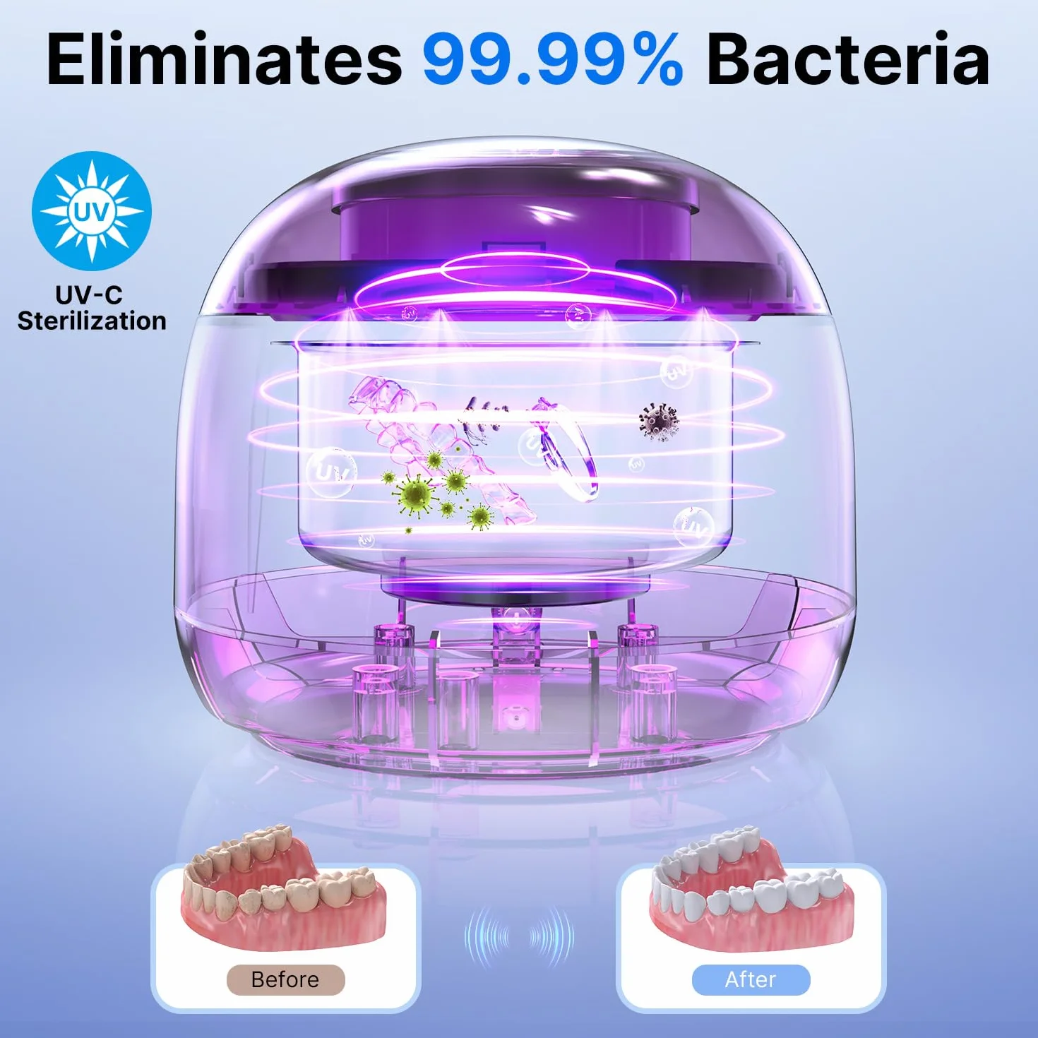 ITSHINY Ultradźwiękowy środek czyszczący, 45000 Hz, pojemnik ultradźwiękowy, 200 ml lampa UV, 25 W ultradźwiękowy środek czyszczący do rynny dentystycznej, protez dentystycznych, przyrządów