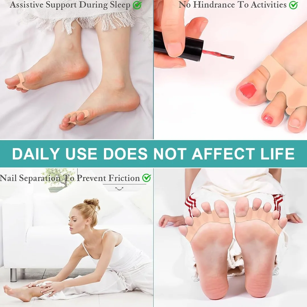 4 sztuki silikonowych separatorów palców u stóp, korekcja hallux valgus, wielokrotnie zmywalne żelowe separatory palców, separatory palców dla wszystkich palców u stóp, rozpórki palców u stóp