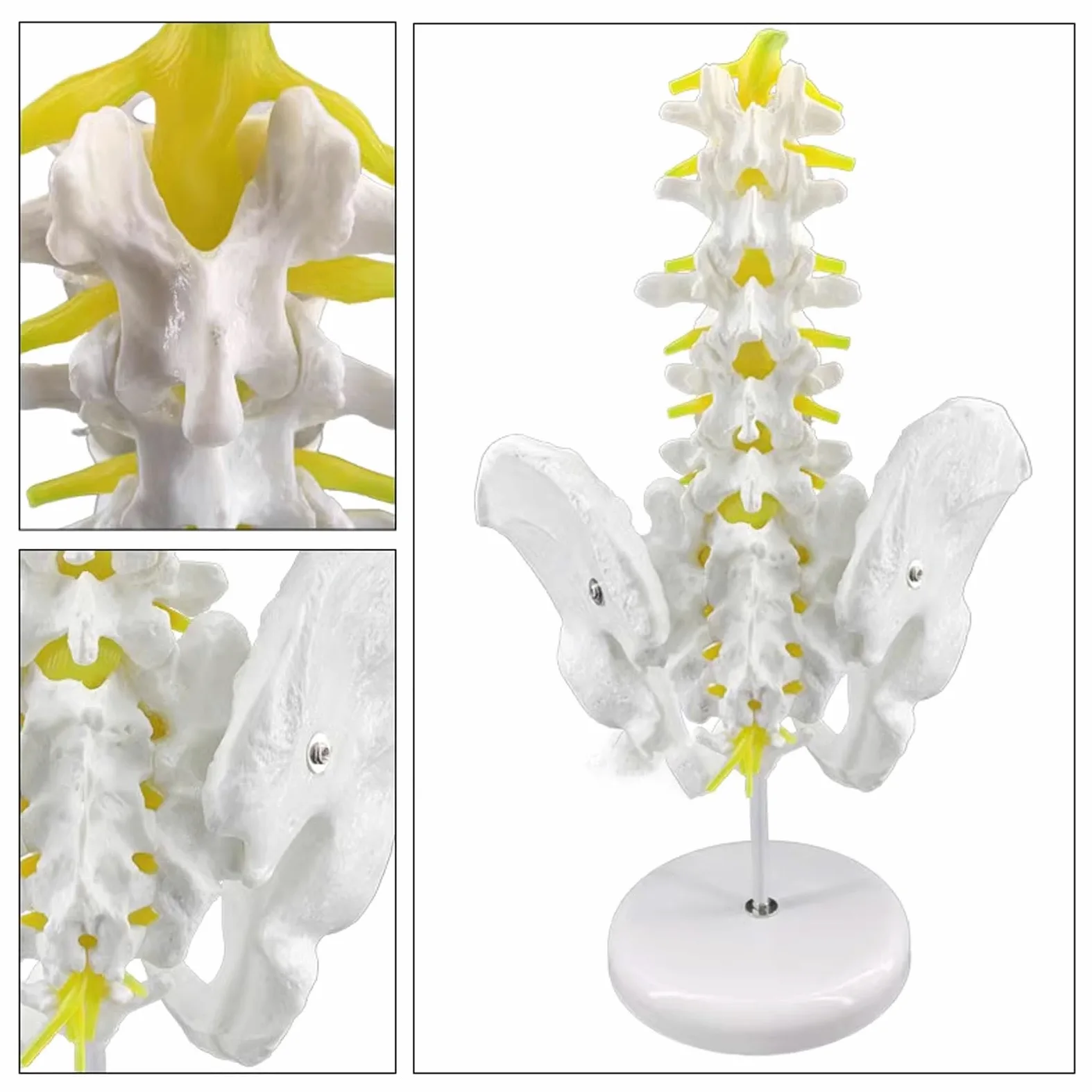 1:1 Anatomiczny męski model miednicy Sacrum Pubis Zmiany patologiczne człowiek Szkielet Zestaw modeli Materiały laboratoryjne Narzędzie do nauki w szkole