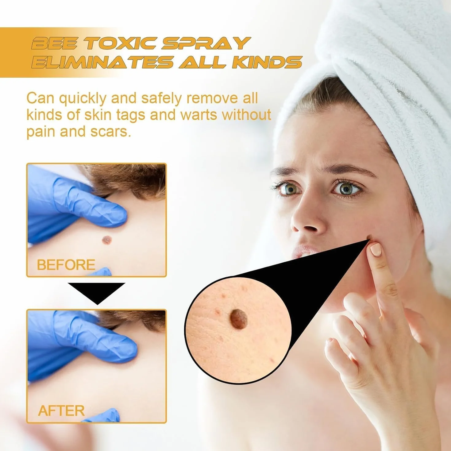 Tag Recede Bee Venom, 20 ml Tag Recede Bee Venom Spray, Tagrecede Bee Venom Skin Spray (1 szt.)