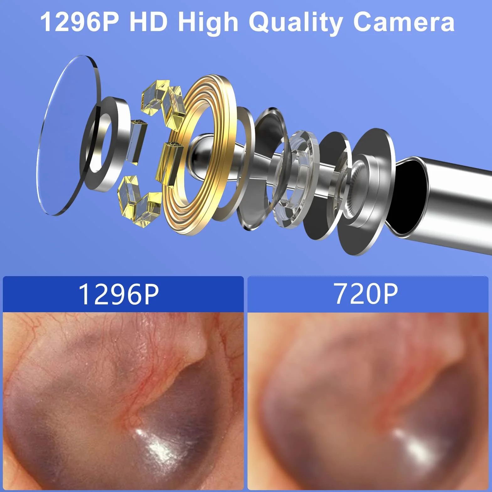 Otoskop VITCOCO Zestaw do usuwania woskowiny Środek do czyszczenia uszu 1296P Środek do usuwania woskowiny Wodoodporna kamera endoskopowa do uszu 3,5 mm, do iPhone'a, iPada i Androida,czarny