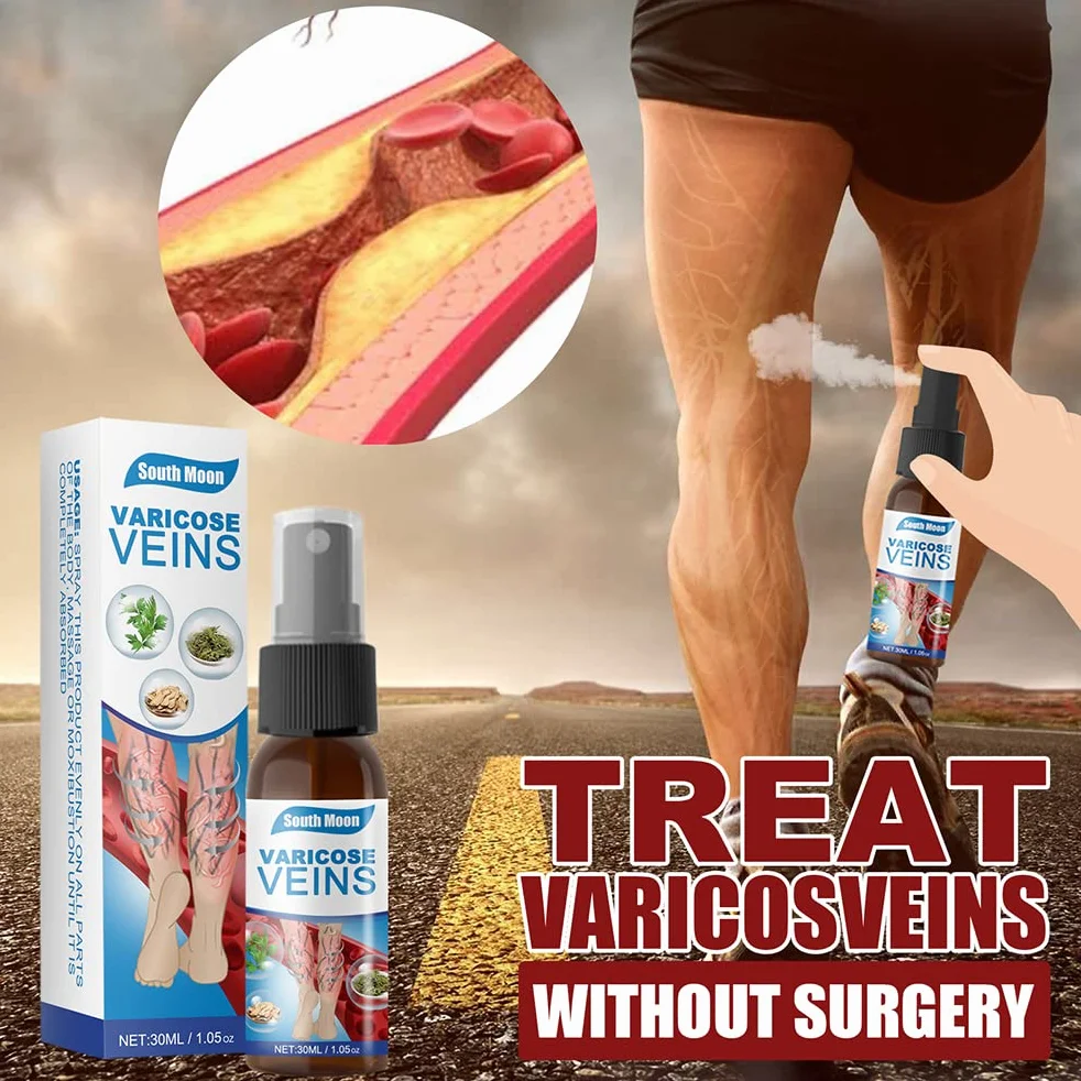 Veinhealing Veins Treatment Spray, 3 szt. Spray do żylaków Veinhealing, naturalny spray ziołowy dla żylaków, 30 ml