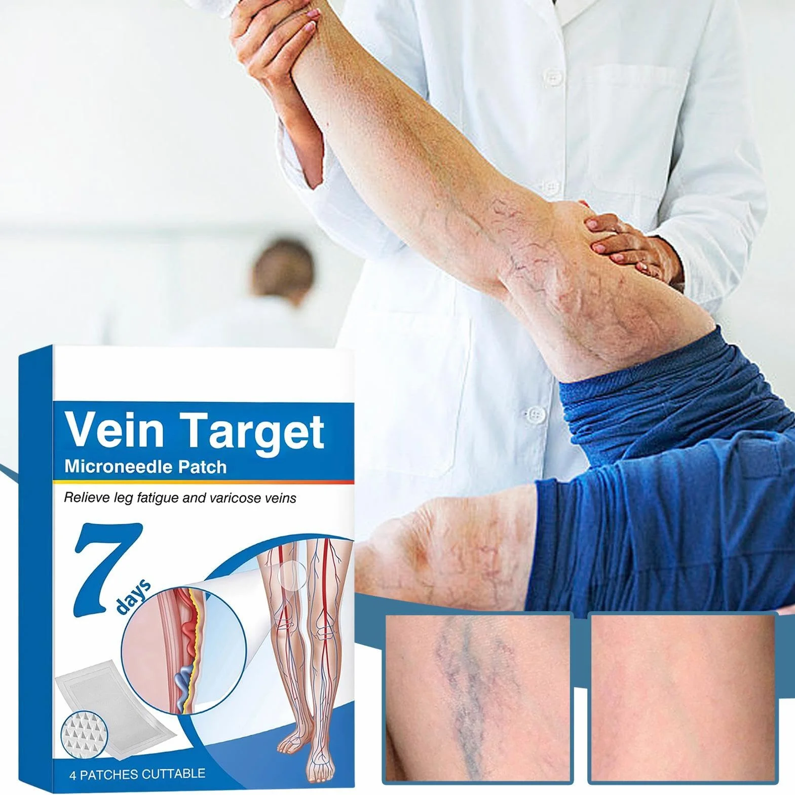 Vein Target plastry z mikroigłami | Zaawansowane plastry na żylaki | 4 sztuki Naturalne Długotrwałe Oddychające Łagodzenie Dyskomfortu Podkładki na Nogi Dla Mężczyzn Kobiet Dorosłych Seniorów