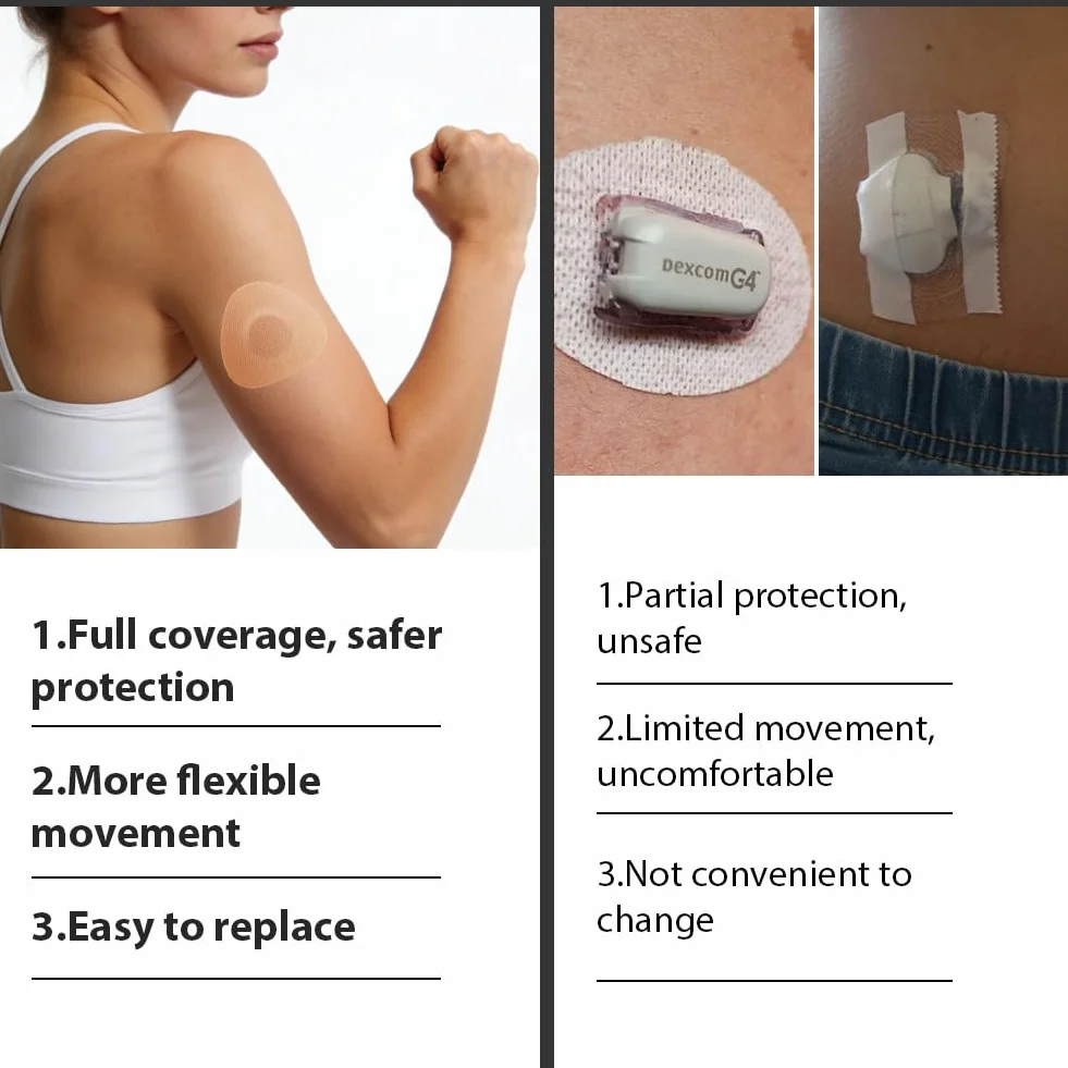 AUYAO Plastry z czujnikami – 20 sztuk, przyjazne dla skóry Libre 2, wodoodporne, odporne na pot, mocne, cienkie, samoprzylepne, naklejki Overpatch do czujników Libre 2, 70 mm, kolor