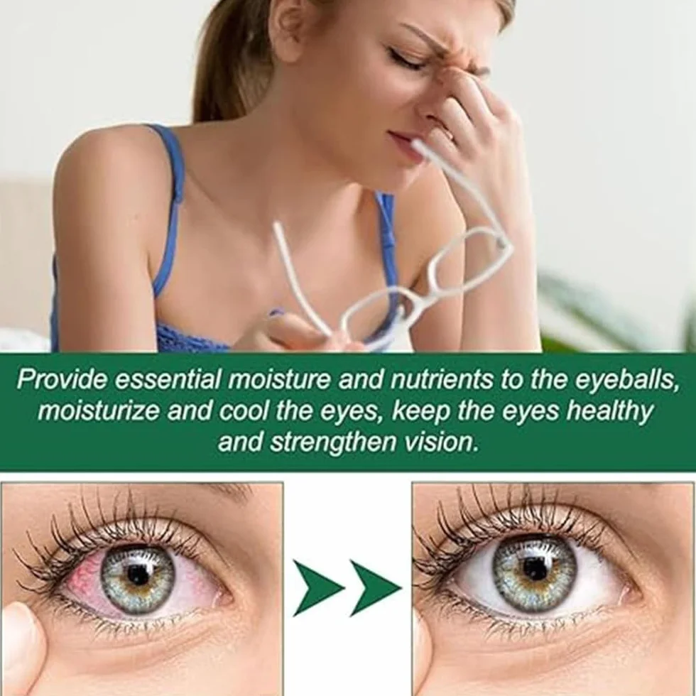 Optivipro Presbyopia Eye Drops,Vision Recovery Eye Drops,Relieve Eye Fatigue,For Eye Care (20Pcs)