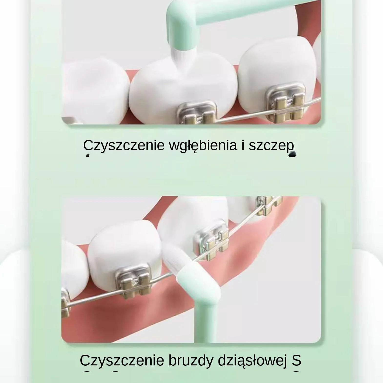 Gum End Tuft Toothbrush, Precise Soft Orthodontic Cleaning Brush, Small Head Design, Care Tool, Home, Dormitory, Hotel, Travel, Apartment