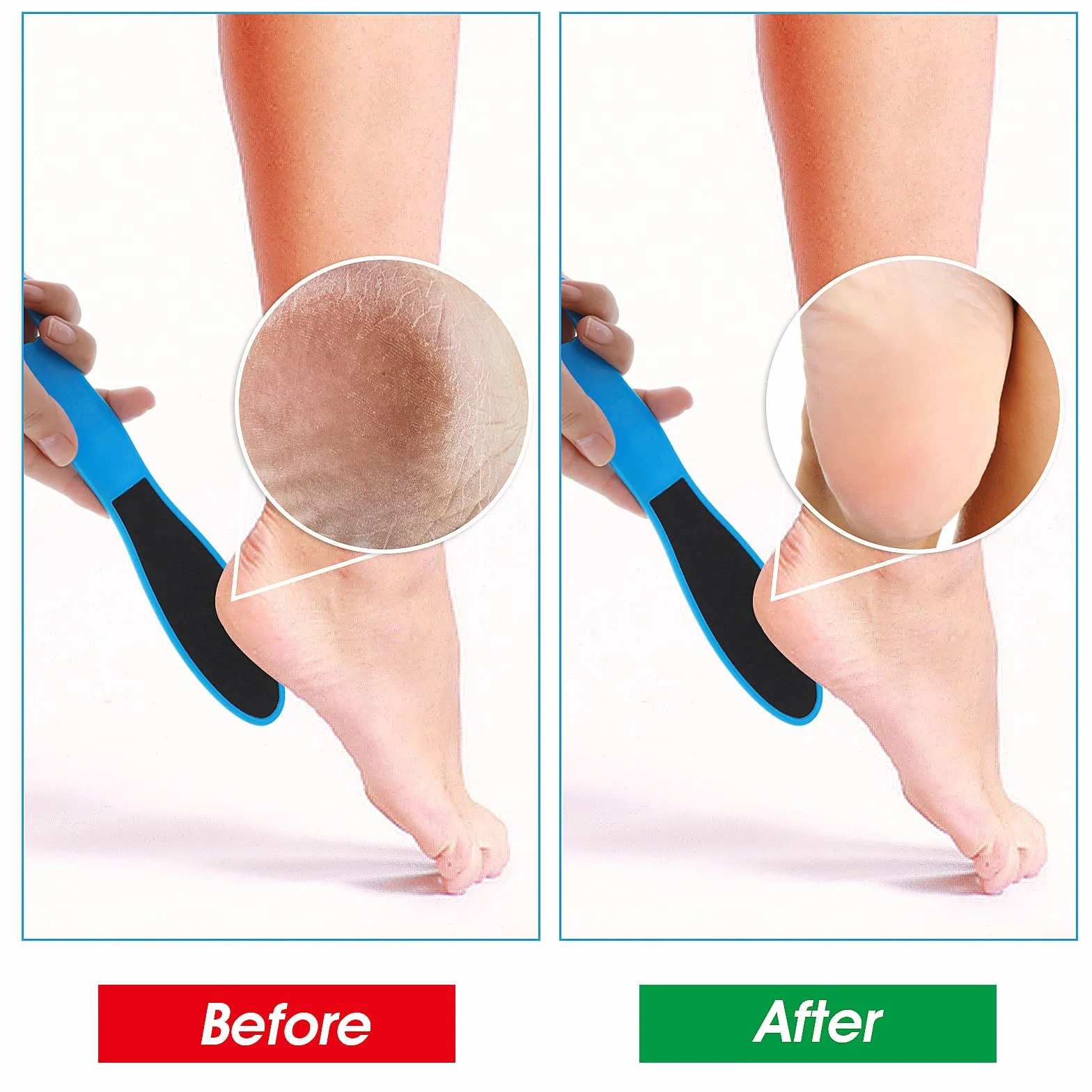 WLLHYF Dwustronny skrobak do stóp, pilnik do stóp, złuszczacz, martwy naskórek, twardy naskórek, peeling do stóp, wielokrotnego użytku, narzędzie do pedicure, do mokrych i suchych pękniętych stóp, 2