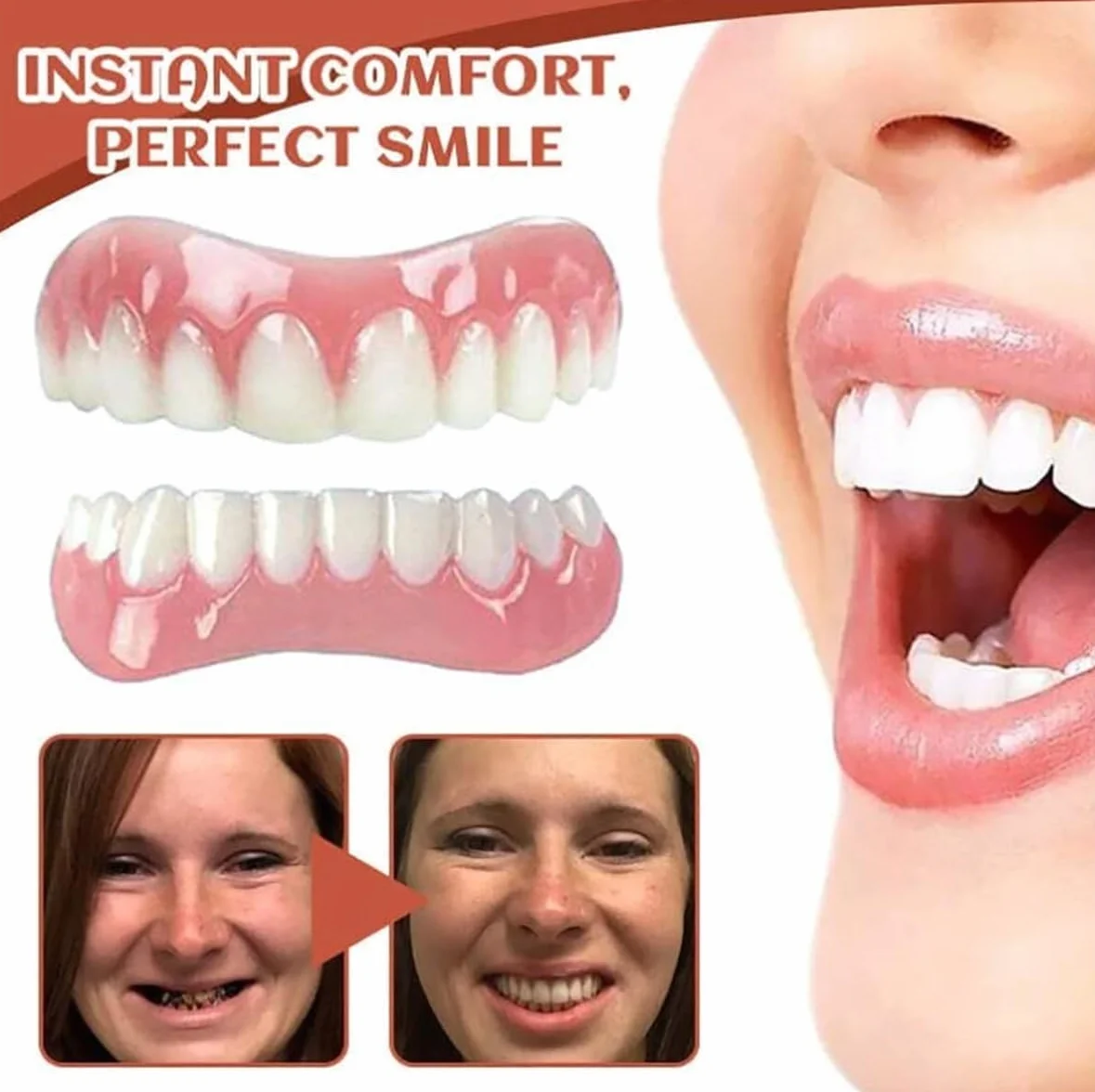 Denture Silicone Reline Kit - Silicone Reline Kit for Dentures - PerfectFit Denture Reline for Customized Comfort - For Women and Men(3 pcs)